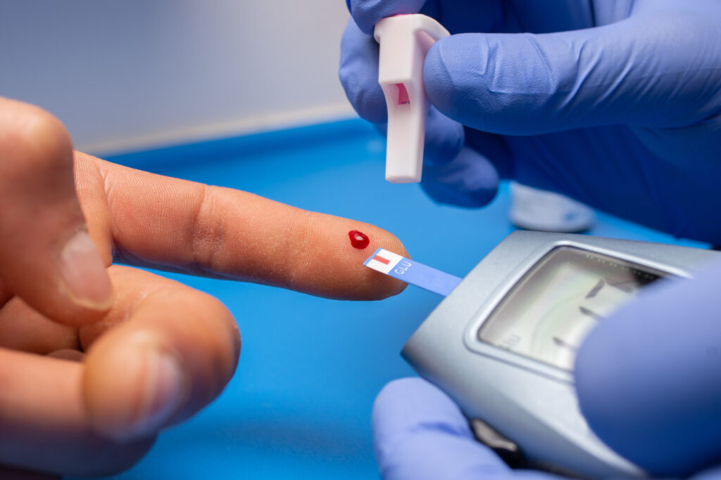 Blood Glucose Monitoring